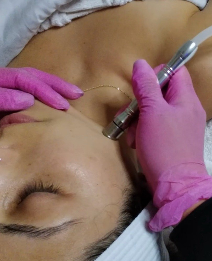 Microdermabrasion Facial treatment